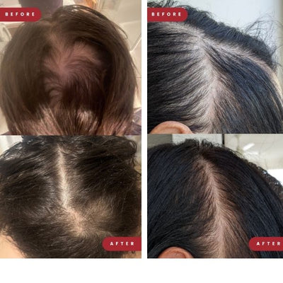 Before and after hair growth result