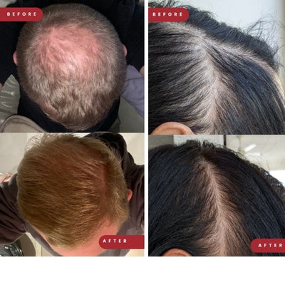 Before and after hair growth result